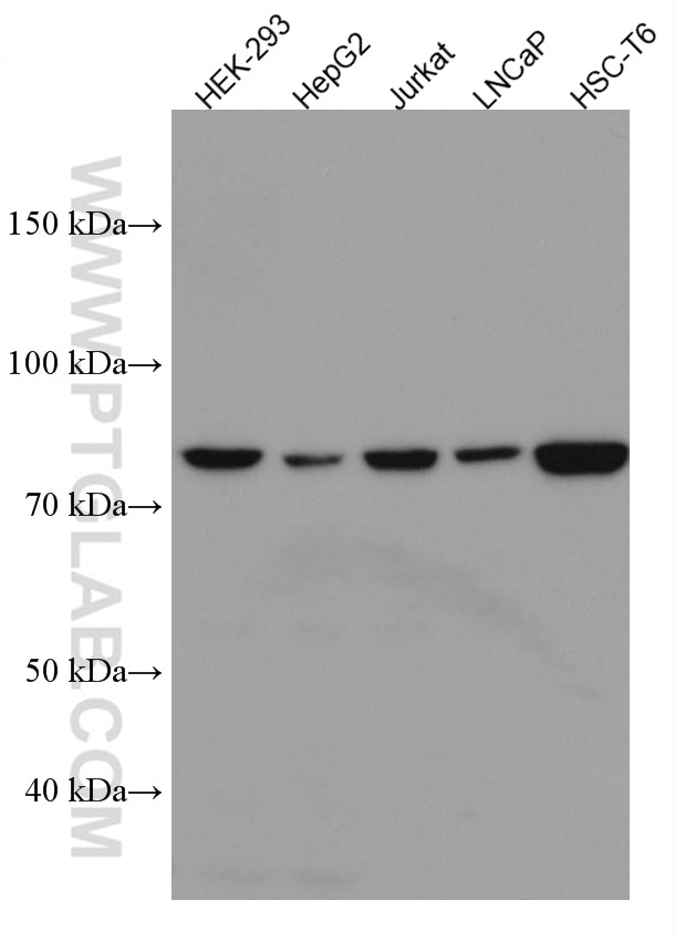 Western Blot (WB) analysis of various lysates using TBK1 Monoclonal antibody (67211-1-Ig)