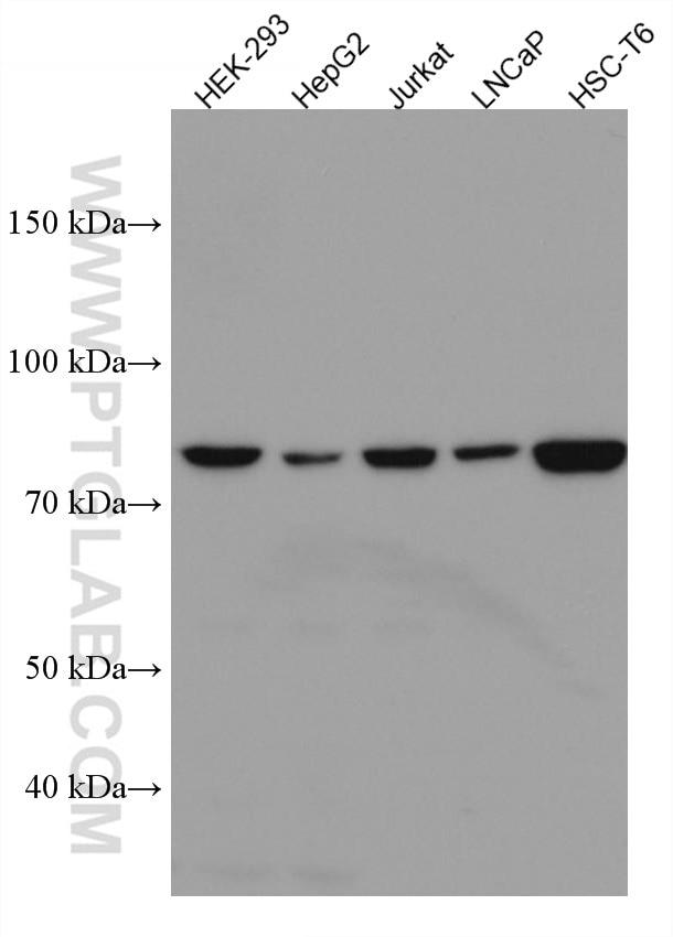 WB analysis using 67211-1-Ig