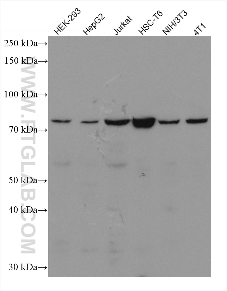 Western Blot (WB) analysis of various lysates using TBK1 Monoclonal antibody (67211-1-Ig)