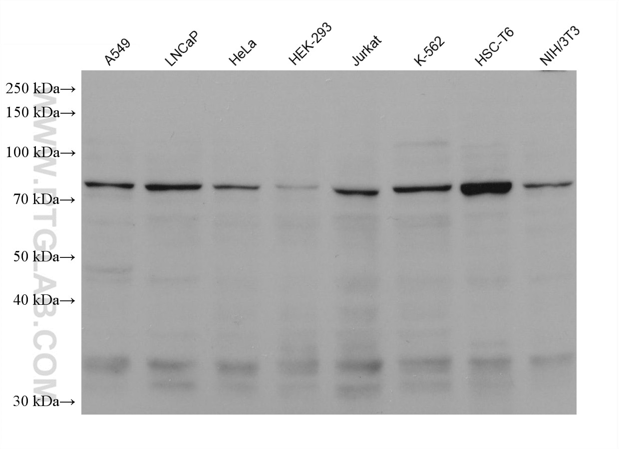 Western Blot (WB) analysis of various lysates using TBK1 Monoclonal antibody (67211-1-Ig)