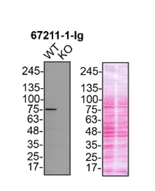 Western Blot (WB) analysis of U2OS cells using TBK1 Monoclonal antibody (67211-1-Ig)