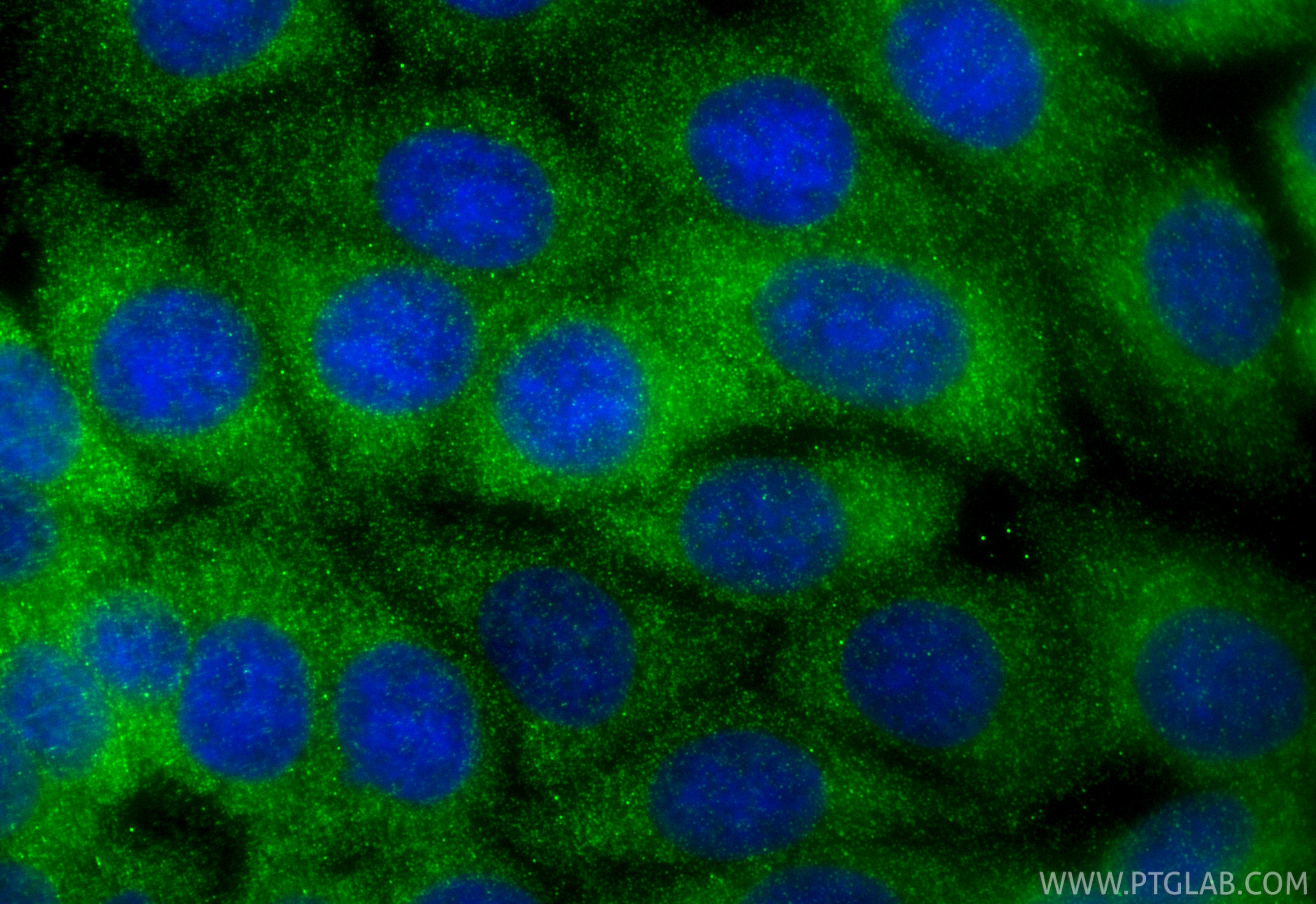 Immunofluorescence (IF) / fluorescent staining of MCF-7 cells using TBK1 Recombinant antibody (83686-3-RR)