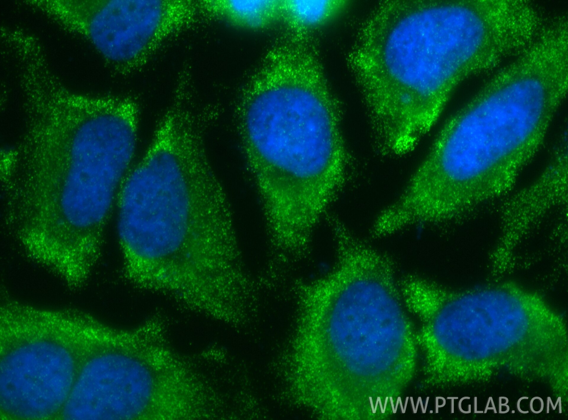 Immunofluorescent analysis of (-20°C Ethanol) fixed HeLa cells using TBK1 antibody (83686-3-RR, Clone: 240769G5 ) at dilution of 1:400 and CoraLite®488-Conjugated Goat Anti-Rabbit IgG(H+L) (SA00013-2). Immunofluorescence (IF) / fluorescent staining of HeLa cells using TBK1 Recombinant monoclonal antibody (83686-3-RR)