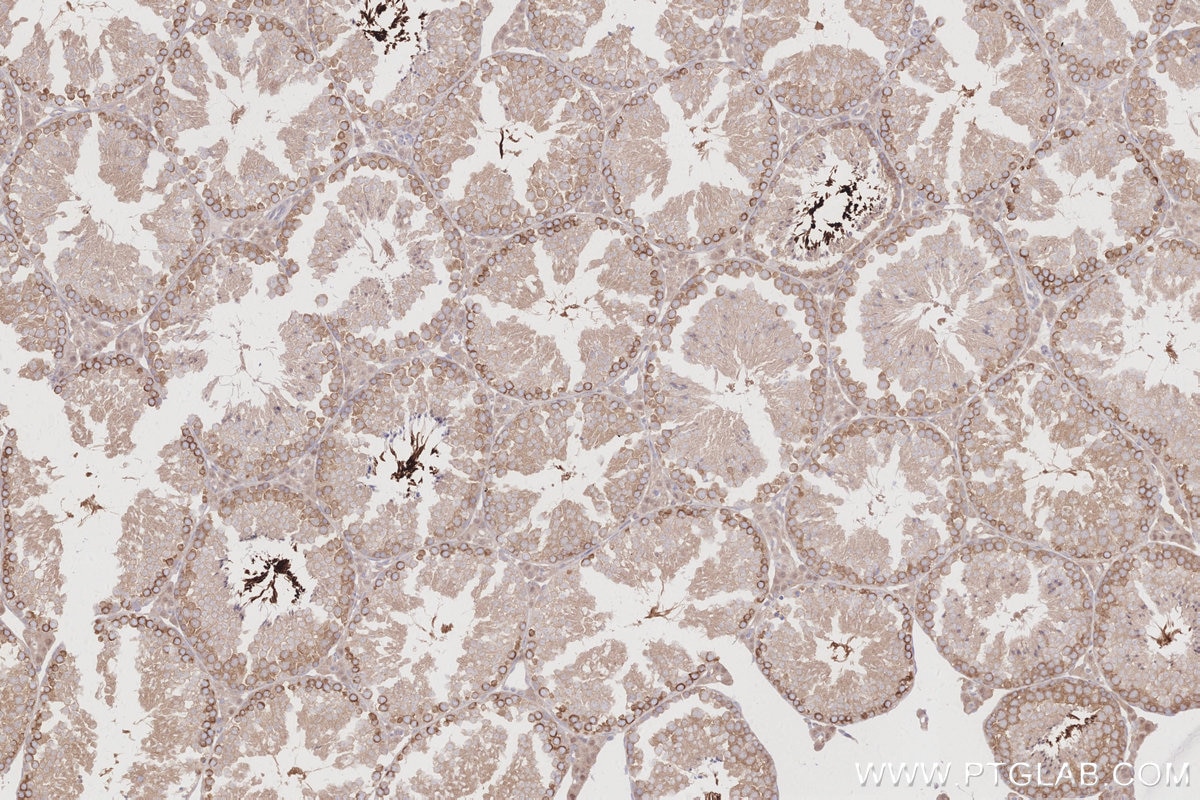 Immunohistochemistry (IHC) staining of mouse testis tissue using TBK1 Recombinant antibody (83686-3-RR)