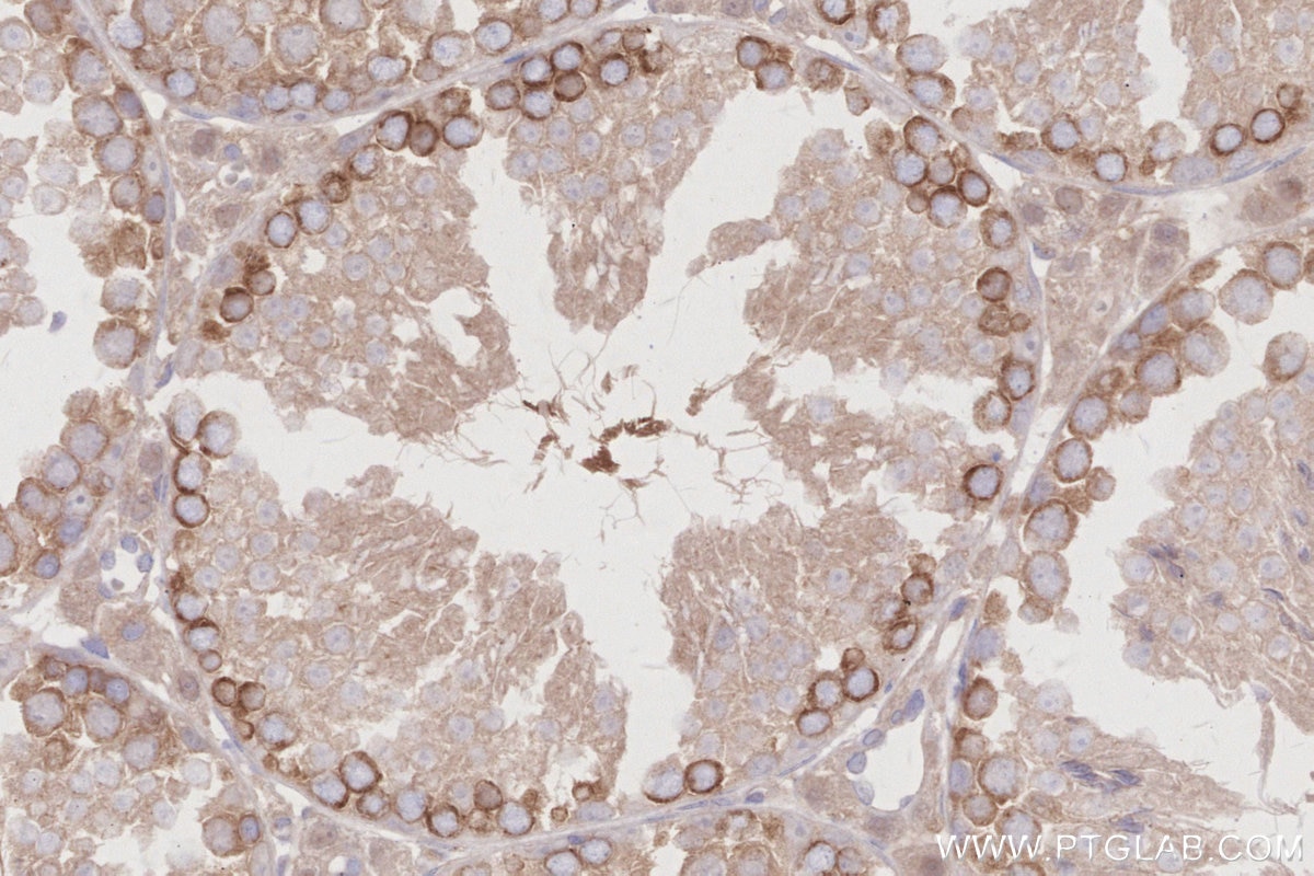 Immunohistochemistry (IHC) staining of mouse testis tissue using TBK1 Recombinant antibody (83686-3-RR)