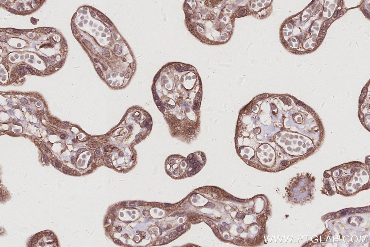 Immunohistochemistry (IHC) staining of human placenta tissue using TBK1 Recombinant antibody (83686-3-RR)