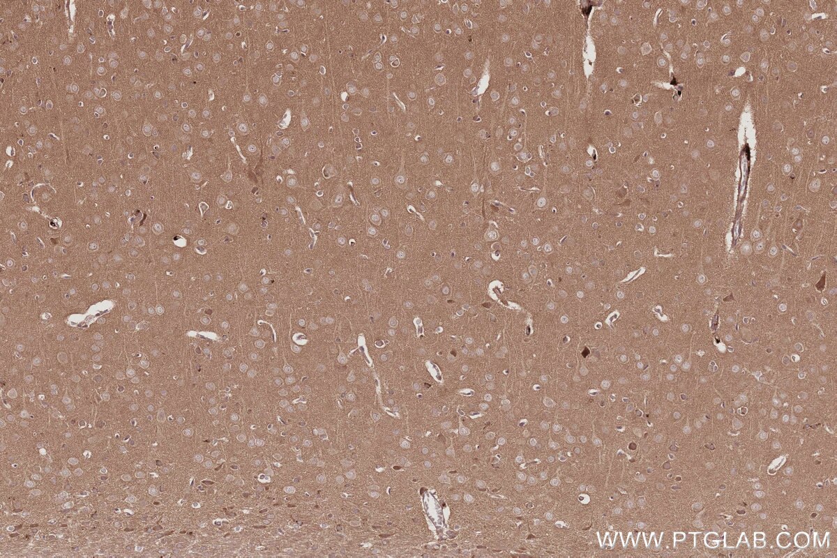 Immunohistochemistry (IHC) staining of rat brain tissue using TBK1 Recombinant monoclonal antibody (83686-3-RR)