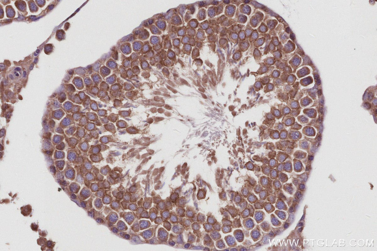 Immunohistochemistry (IHC) staining of rat testis tissue using TBK1 Recombinant monoclonal antibody (83686-3-RR)