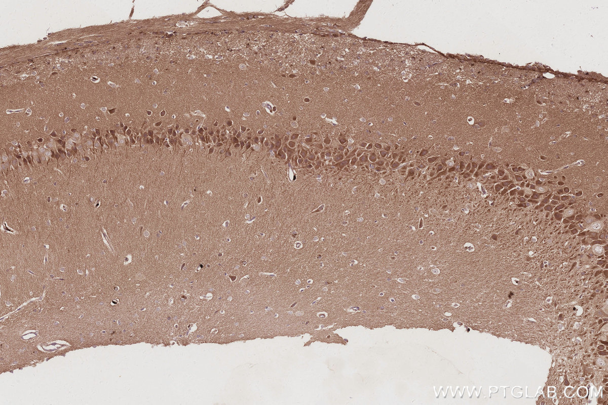 Immunohistochemistry (IHC) staining of rat brain tissue using TBK1 Recombinant monoclonal antibody (83686-3-RR)