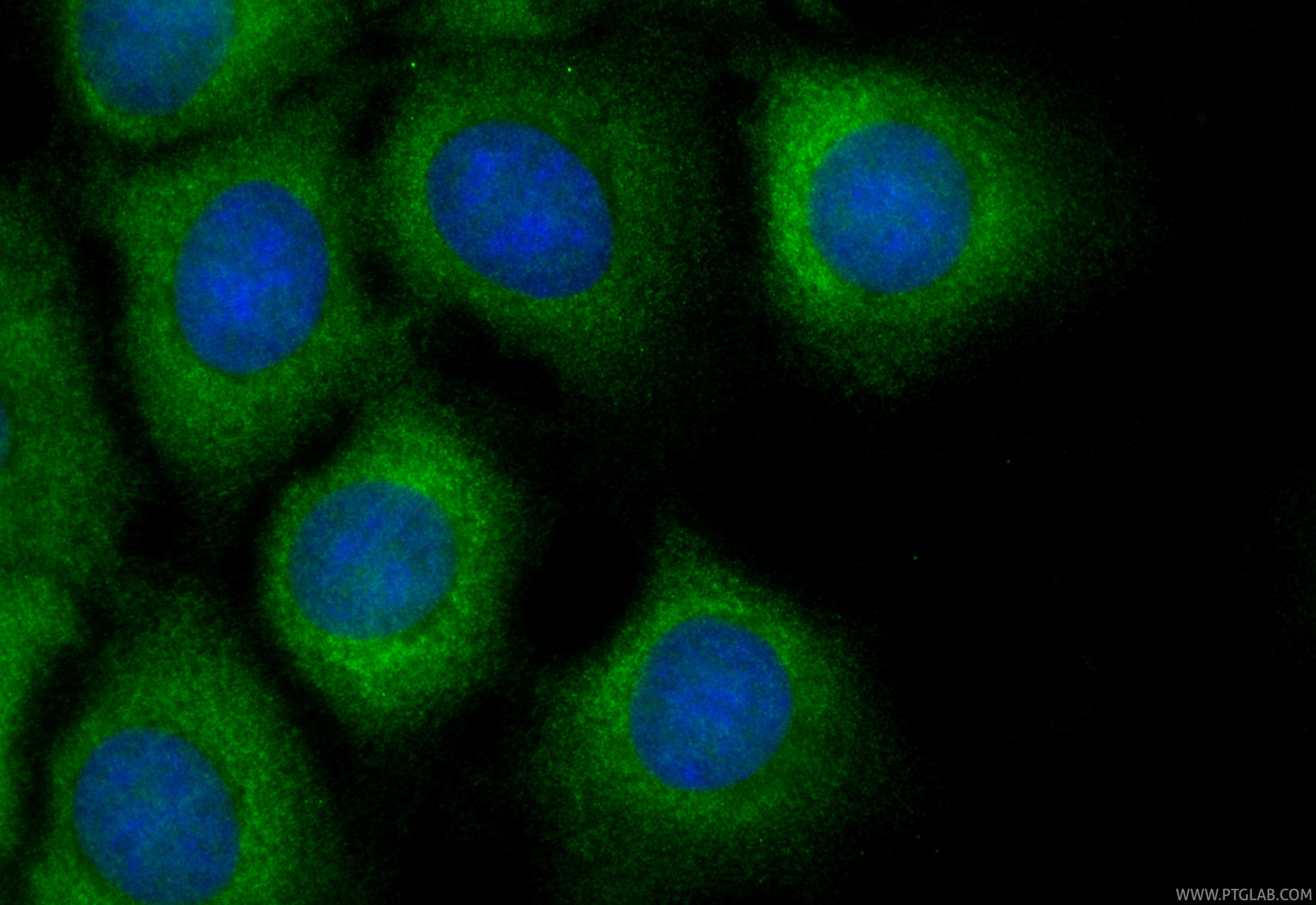 Immunofluorescence (IF) / fluorescent staining of MCF-7 cells using CoraLite® Plus 488-conjugated TBK1 Recombinant mon (CL488-83686-3)