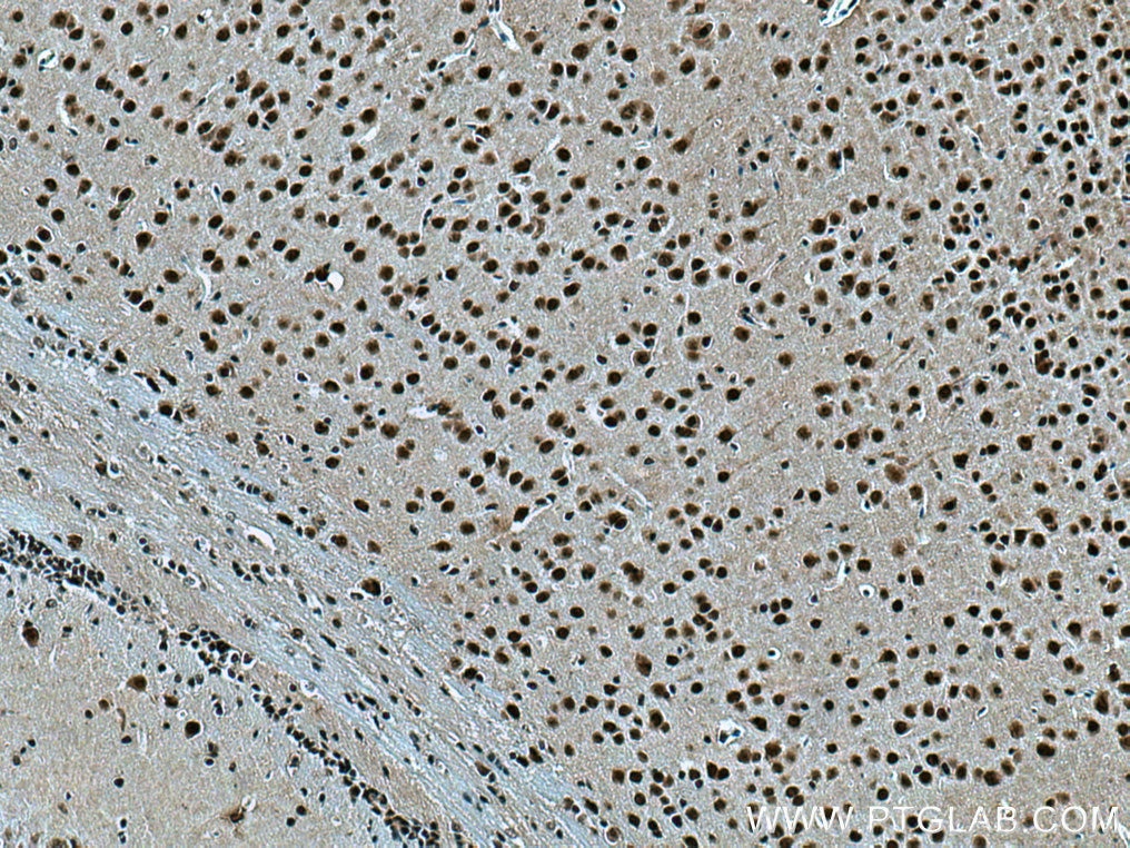 Immunohistochemistry (IHC) staining of mouse brain tissue using TBL1X Polyclonal antibody (13540-1-AP)