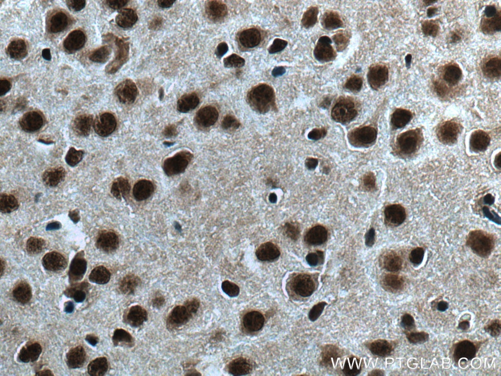 Immunohistochemistry (IHC) staining of mouse brain tissue using TBL1X Polyclonal antibody (13540-1-AP)