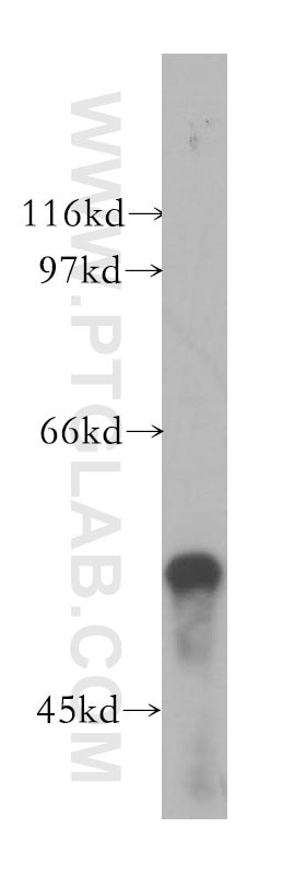 Western Blot (WB) analysis of mouse pancreas tissue using TBL1X Polyclonal antibody (13540-1-AP)