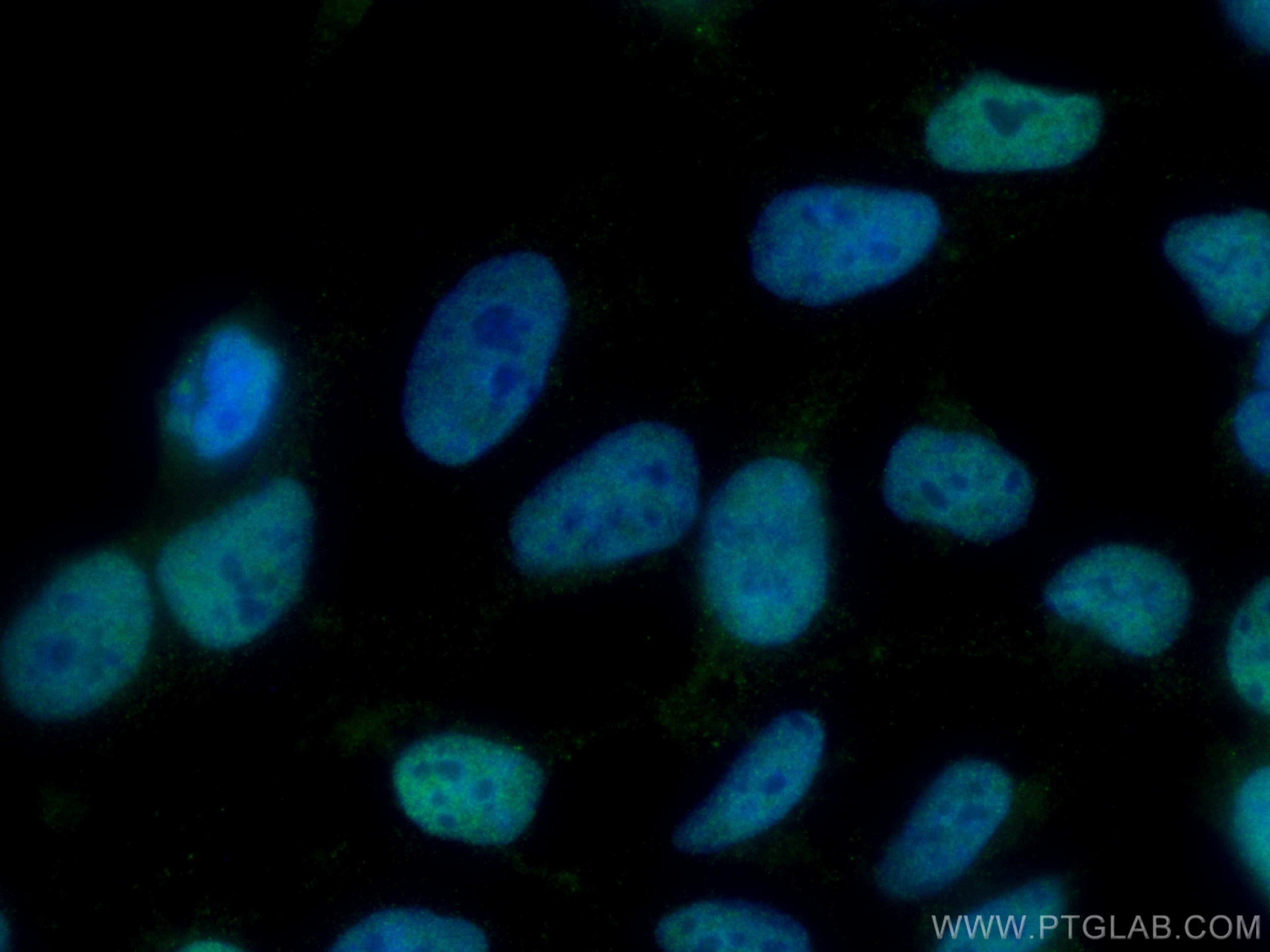 Immunofluorescence (IF) / fluorescent staining of HEK-293 cells using TBL1X Monoclonal antibody (66955-1-Ig)