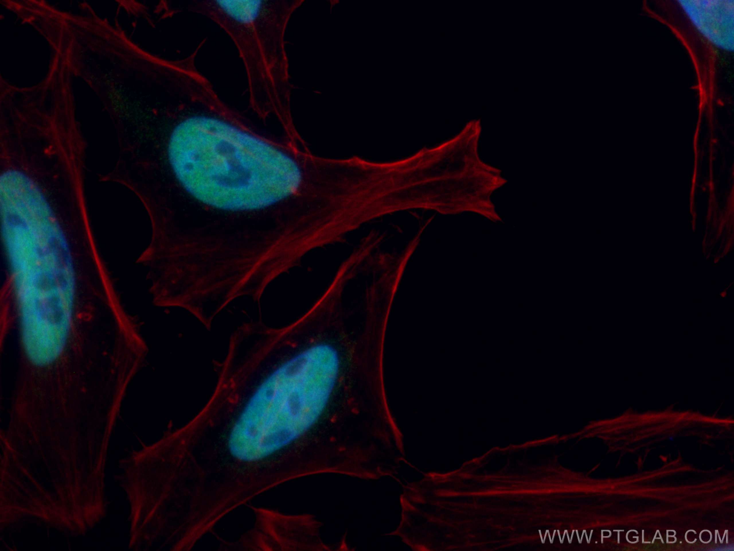 Immunofluorescence (IF) / fluorescent staining of HeLa cells using CoraLite® Plus 488-conjugated TBL1X Monoclonal ant (CL488-66955)