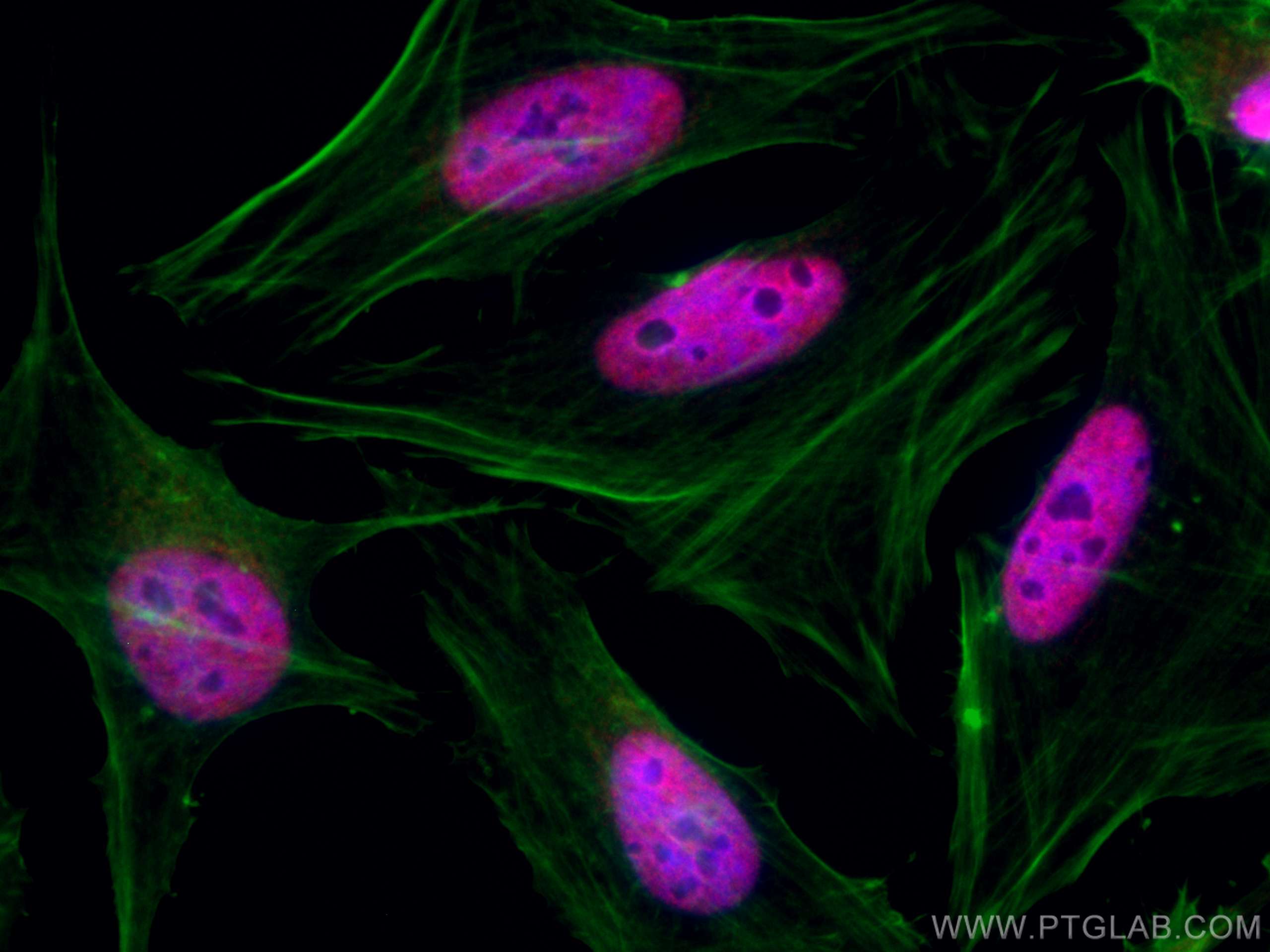 Immunofluorescence (IF) / fluorescent staining of HeLa cells using CoraLite®594-conjugated TBL1X Monoclonal antibody (CL594-66955)