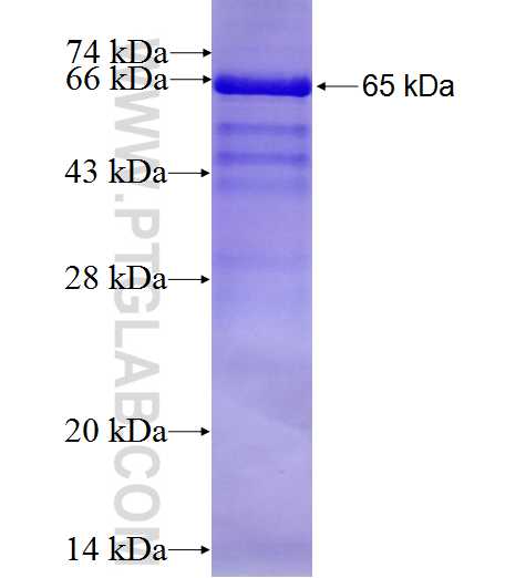 TBL1X fusion protein Ag4477 SDS-PAGE