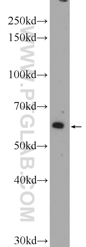 TBL1XR1 Polyclonal antibody