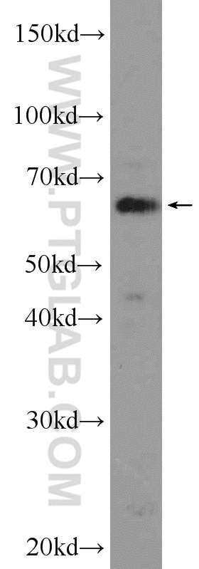 Western Blot (WB) analysis of MCF-7 cells using TBL1XR1 Polyclonal antibody (55312-1-AP)