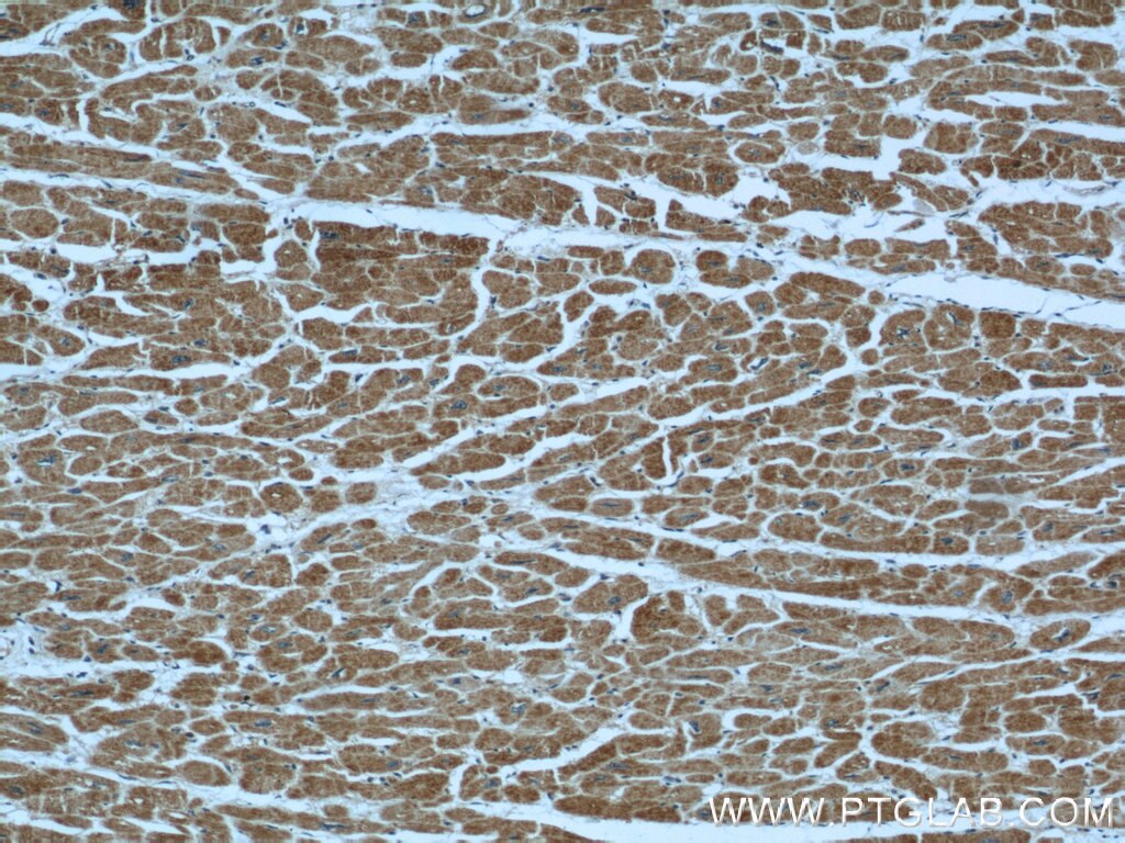 Immunohistochemistry (IHC) staining of human heart tissue using TBL2 Polyclonal antibody (12488-1-AP)