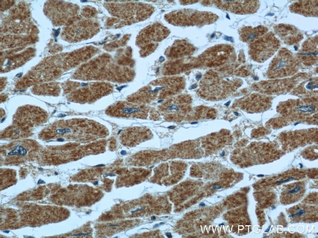 Immunohistochemistry (IHC) staining of human heart tissue using TBL2 Polyclonal antibody (12488-1-AP)