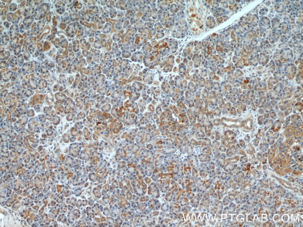 Immunohistochemistry (IHC) staining of human pancreas tissue using TBL2 Polyclonal antibody (12488-1-AP)
