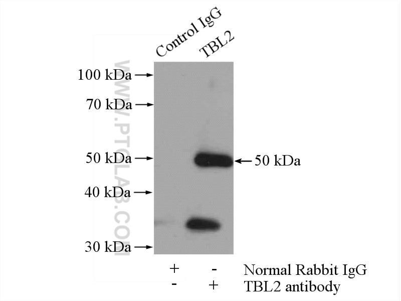 Immunoprecipitation (IP) experiment of COLO 320 cells using TBL2 Polyclonal antibody (12488-1-AP)