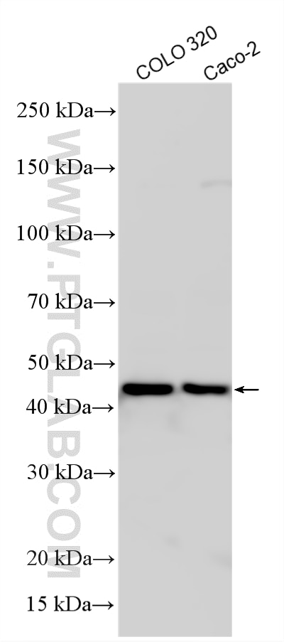 Various lysates were subjected to SDS PAGE followed by western blot with 12488-1-AP (TBL2 antibody) at dilution of 1:2000 incubated at room temperature for 1.5 hours. Western Blot (WB) analysis of various lysates using TBL2 Polyclonal antibody (12488-1-AP)