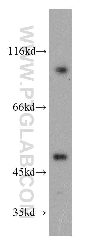 Western Blot (WB) analysis of COLO 320 cells using TBL2 Polyclonal antibody (12488-1-AP)