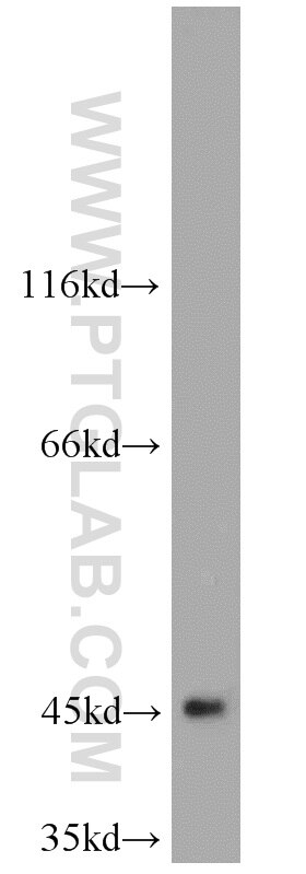 Western Blot (WB) analysis of mouse pancreas tissue using TBL2 Polyclonal antibody (12488-1-AP)