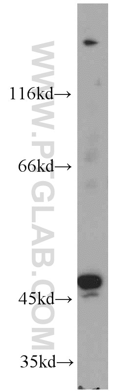 Western Blot (WB) analysis of human placenta tissue using TBL2 Polyclonal antibody (12488-1-AP)