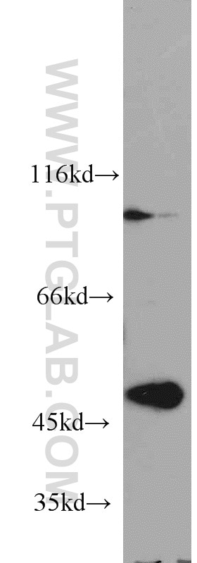 Western Blot (WB) analysis of COLO 320 cells using TBL2 Polyclonal antibody (12488-1-AP)