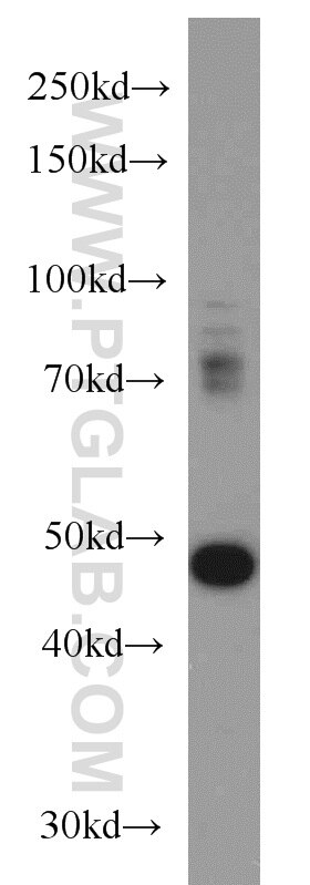 Western Blot (WB) analysis of mouse placenta tissue using TBL2 Polyclonal antibody (12488-1-AP)