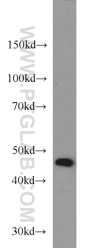 Western Blot (WB) analysis of COLO 320 cells using TBL2 Polyclonal antibody (12488-1-AP)