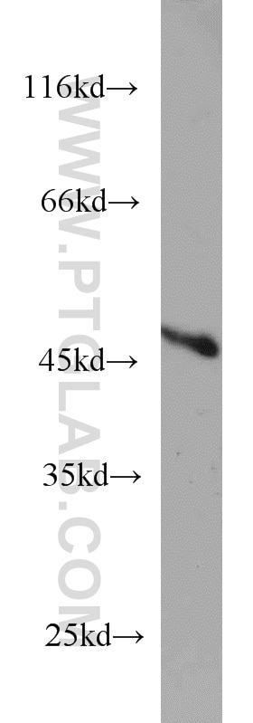 Western Blot (WB) analysis of HeLa cells using TBL2 Polyclonal antibody (12488-1-AP)