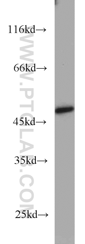 Western Blot (WB) analysis of COLO 320 cells using TBL2 Polyclonal antibody (12488-1-AP)