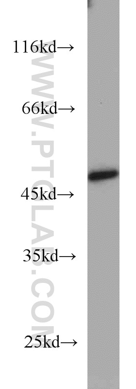 Western Blot (WB) analysis of COLO 320 cells using TBL2 Polyclonal antibody (12488-1-AP)
