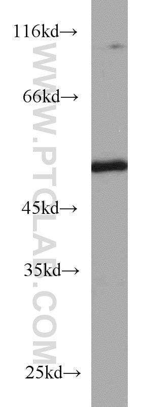 Western Blot (WB) analysis of Jurkat cells using TBL2 Polyclonal antibody (12488-1-AP)