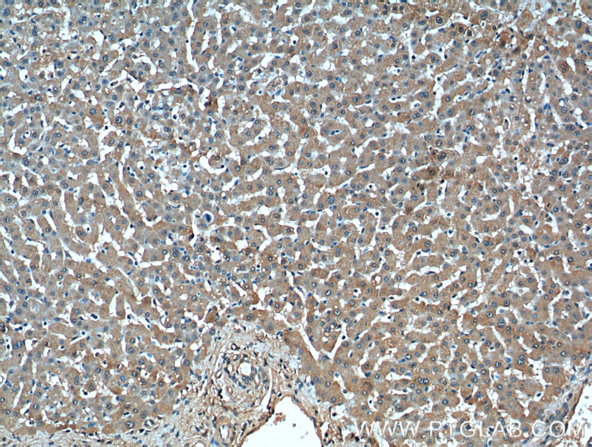 Immunohistochemistry (IHC) staining of human liver tissue using TBL2 Monoclonal antibody (66307-1-Ig)