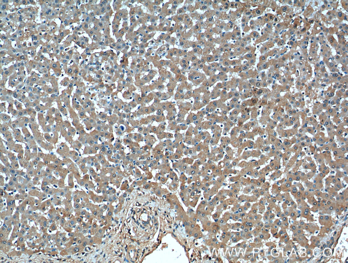 Immunohistochemistry (IHC) staining of human liver tissue using TBL2 Monoclonal antibody (66307-1-Ig)