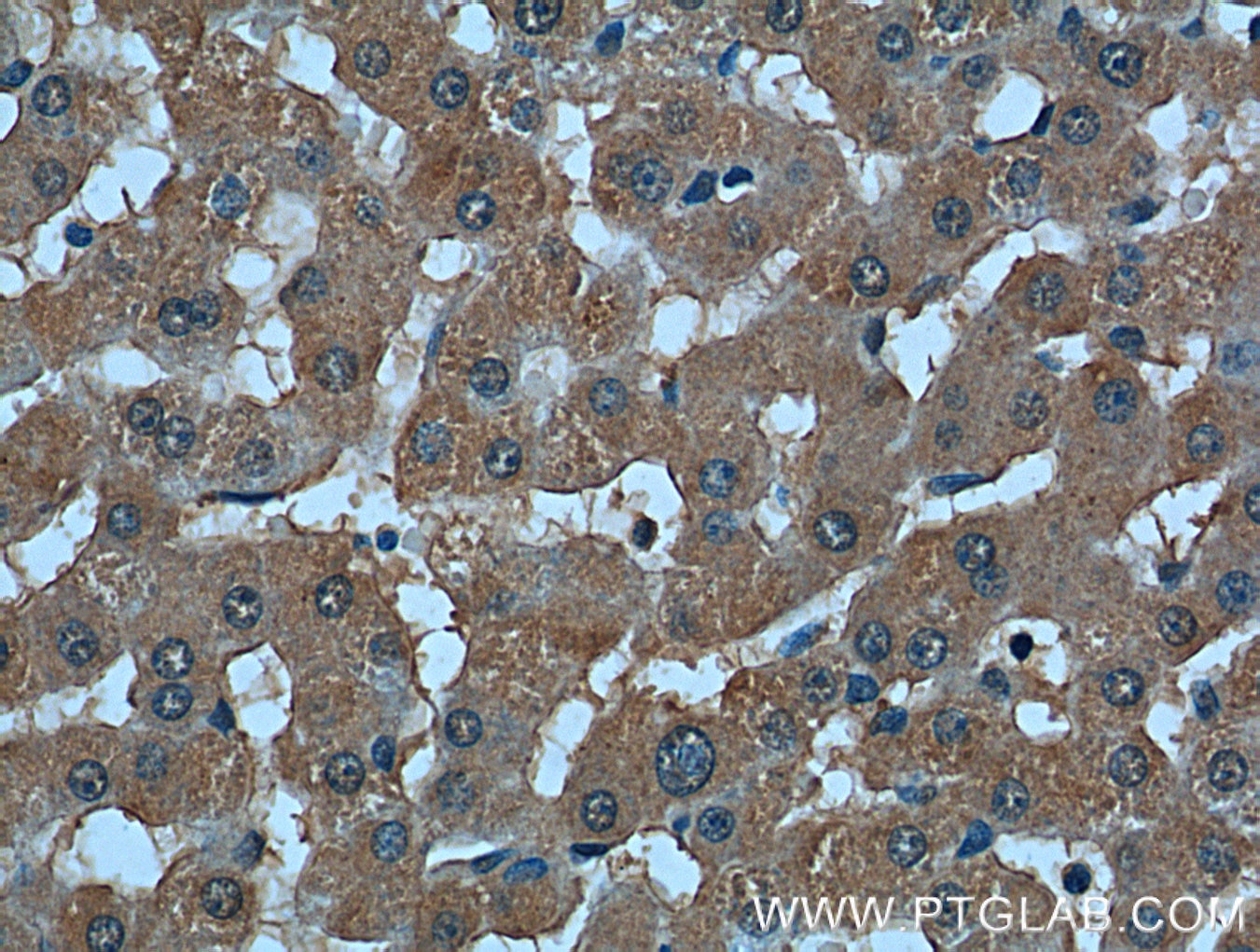 Immunohistochemistry (IHC) staining of human liver tissue using TBL2 Monoclonal antibody (66307-1-Ig)