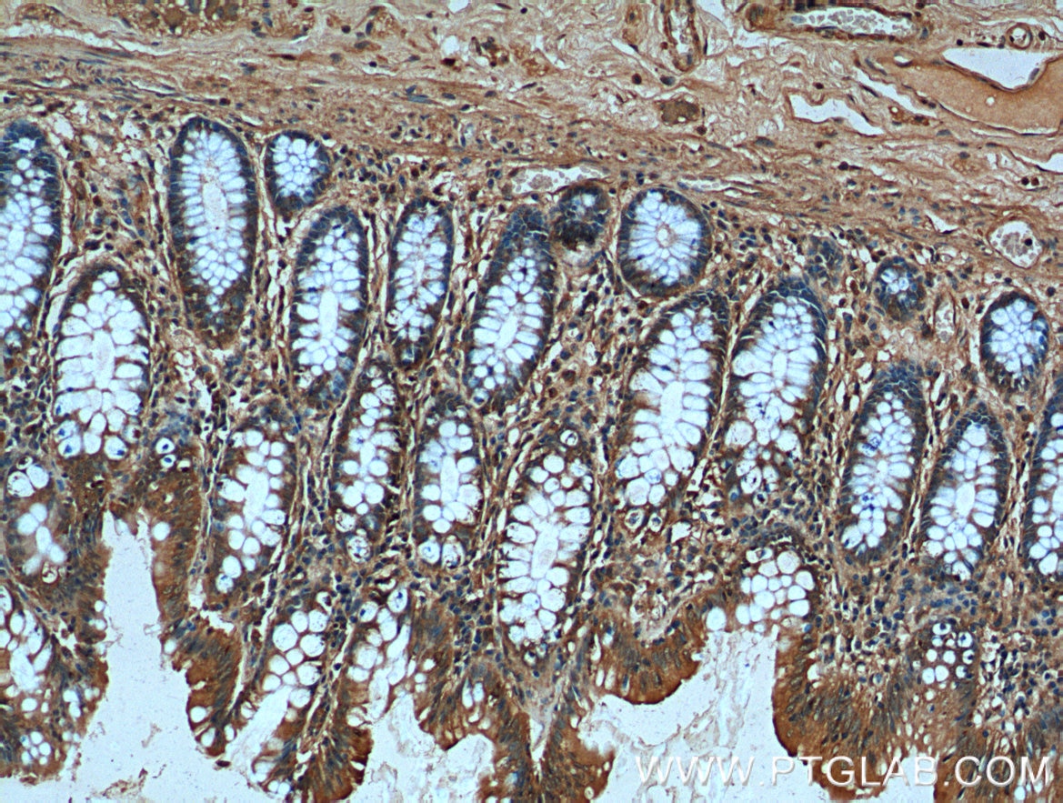 Immunohistochemistry (IHC) staining of human colon tissue using TBL2 Monoclonal antibody (66307-1-Ig)