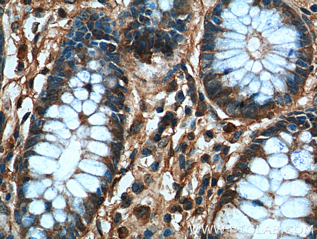 Immunohistochemistry (IHC) staining of human colon tissue using TBL2 Monoclonal antibody (66307-1-Ig)