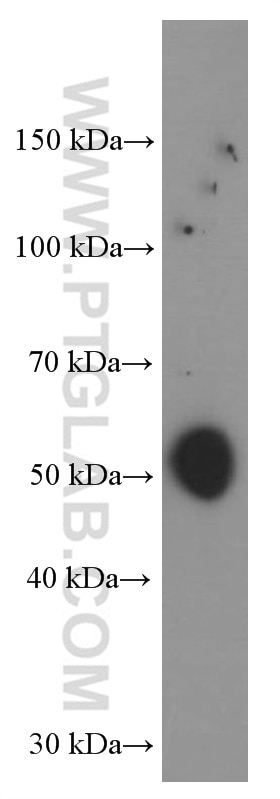 Western Blot (WB) analysis of Jurkat cells using TBL2 Monoclonal antibody (66307-1-Ig)