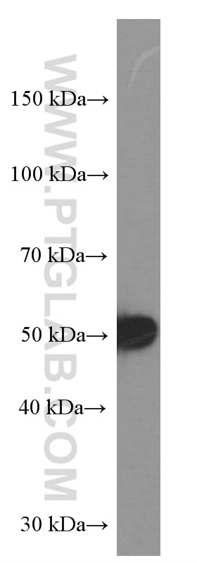 Western Blot (WB) analysis of COLO 320 cells using TBL2 Monoclonal antibody (66307-1-Ig)
