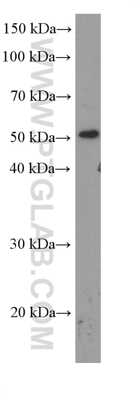 Western Blot (WB) analysis of MCF-7 cells using TBL2 Monoclonal antibody (66307-1-Ig)