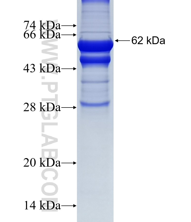 TBL2 fusion protein Ag3200 SDS-PAGE