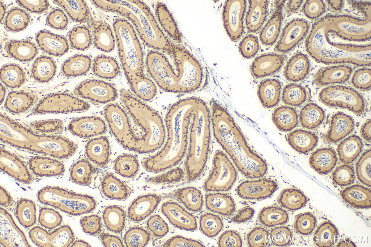 Immunohistochemistry (IHC) staining of mouse testis tissue using TBP Polyclonal antibody (22006-1-AP)
