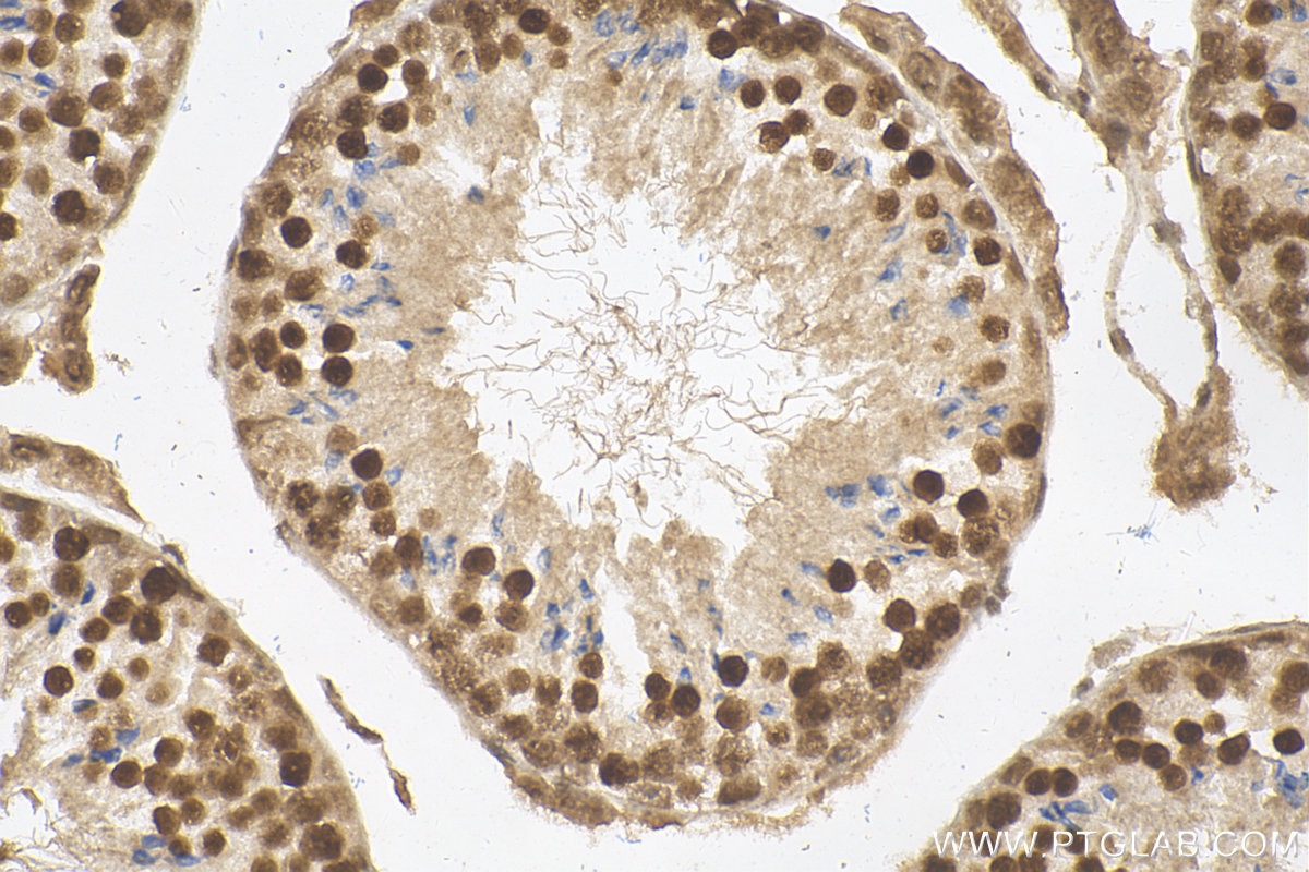 Immunohistochemistry (IHC) staining of mouse testis tissue using TBP Polyclonal antibody (22006-1-AP)