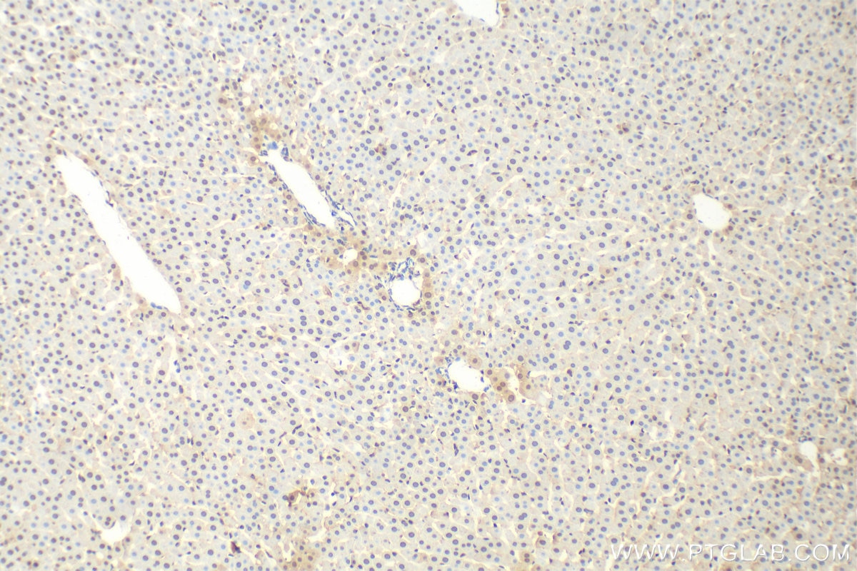 Immunohistochemistry (IHC) staining of rat liver tissue using TBP Polyclonal antibody (22006-1-AP)